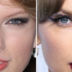 Celebrity Blepharoplasty Before And After: Stunning Results